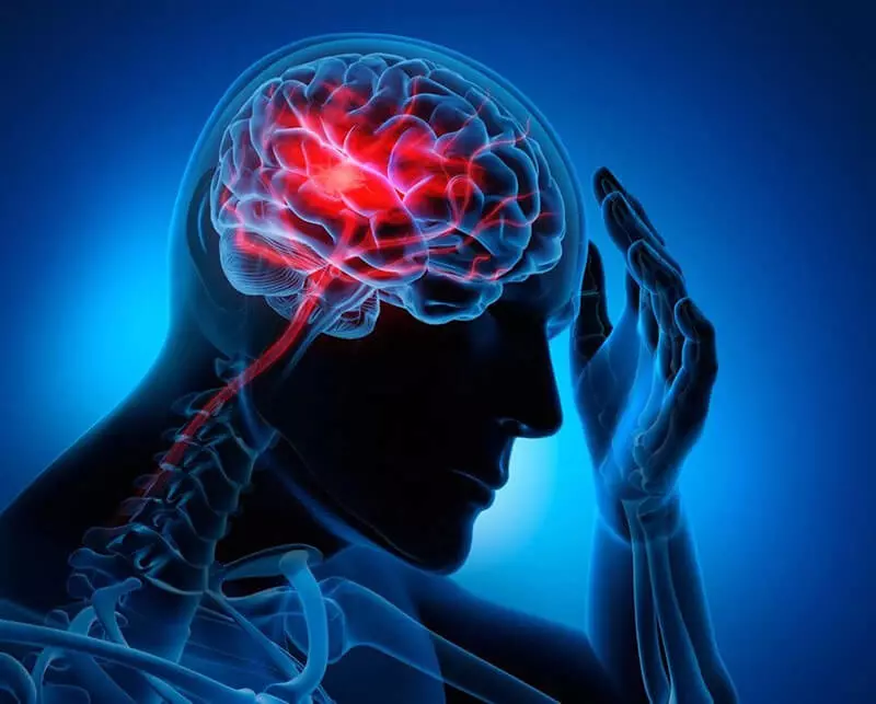 Đột quỵ là gì? đột quỵ hay còn được biết đến với tên gọi tai biến mạch máu não, là trạng thái thiếu máu não bộ