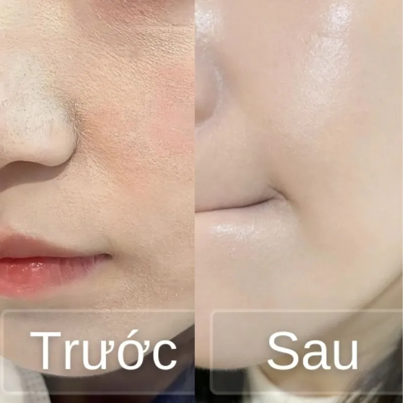 Tạo lớp nền mỏng nhẹ