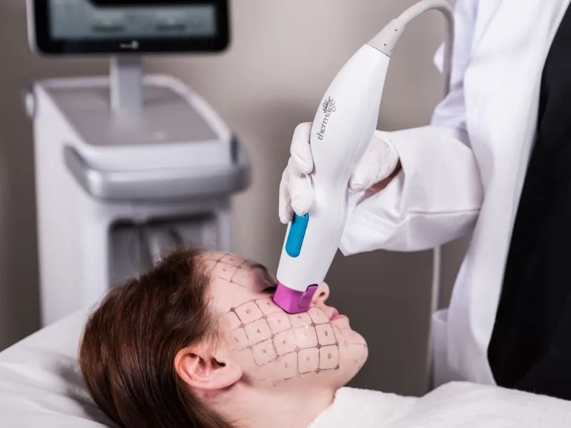 Trẻ hóa da bằng công nghệ Thermage 