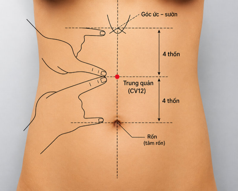 Vị trí huyệt Trung quản CV12: nằm trên đường giữa bụng, cách tâm rốn 4 thốn về phía trên.
